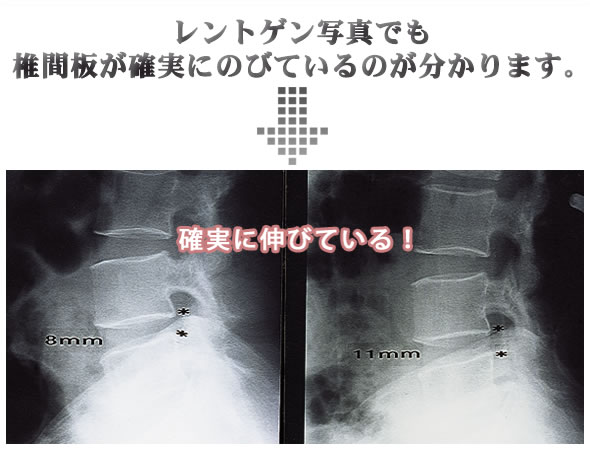 82���̐l��3���ȓ��Ɍ��ʂ������I��C���ŐL�т鍘�x���g�B�i�v���΂����s�𑣐i���A�R�������P���܂���w�f�B�X�N�h�N�^�[�iDiskDoctor�j�x